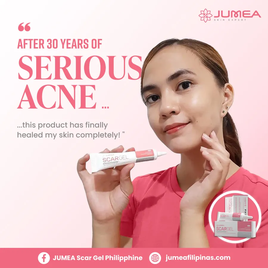 Poster iklan Jumea Scar Gel - Skin Care