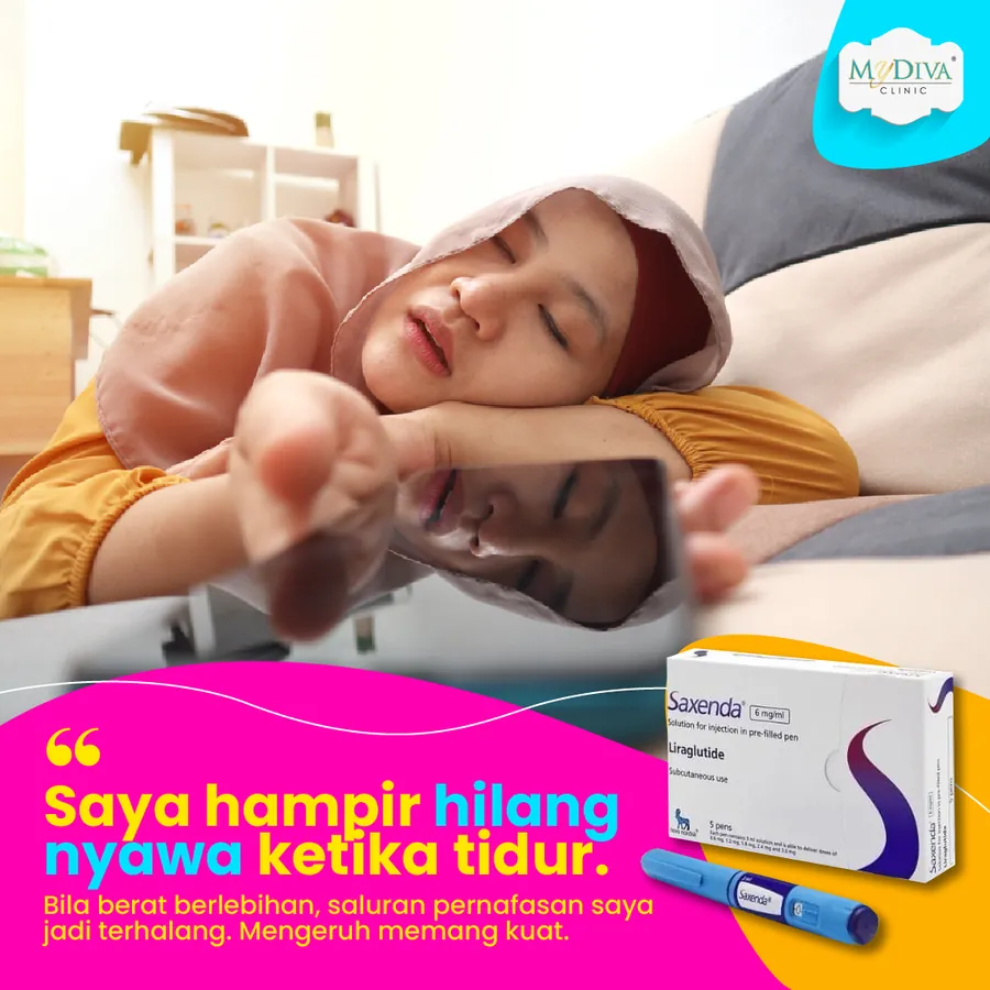 Poster iklan MyDiva Clinic - Produk Kurus