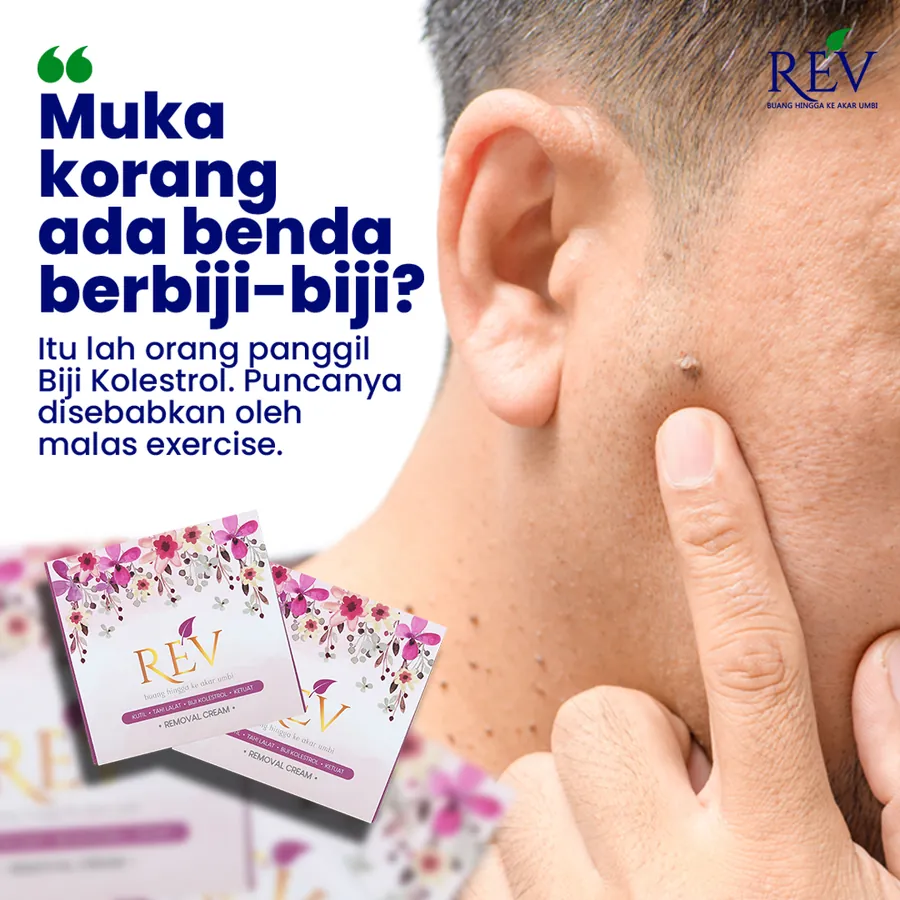 Poster iklan REV Cream - Lain-lain